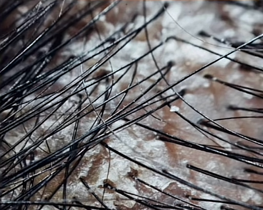 Scalp Detox Maintenance