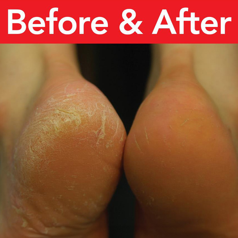 Callous Treatment