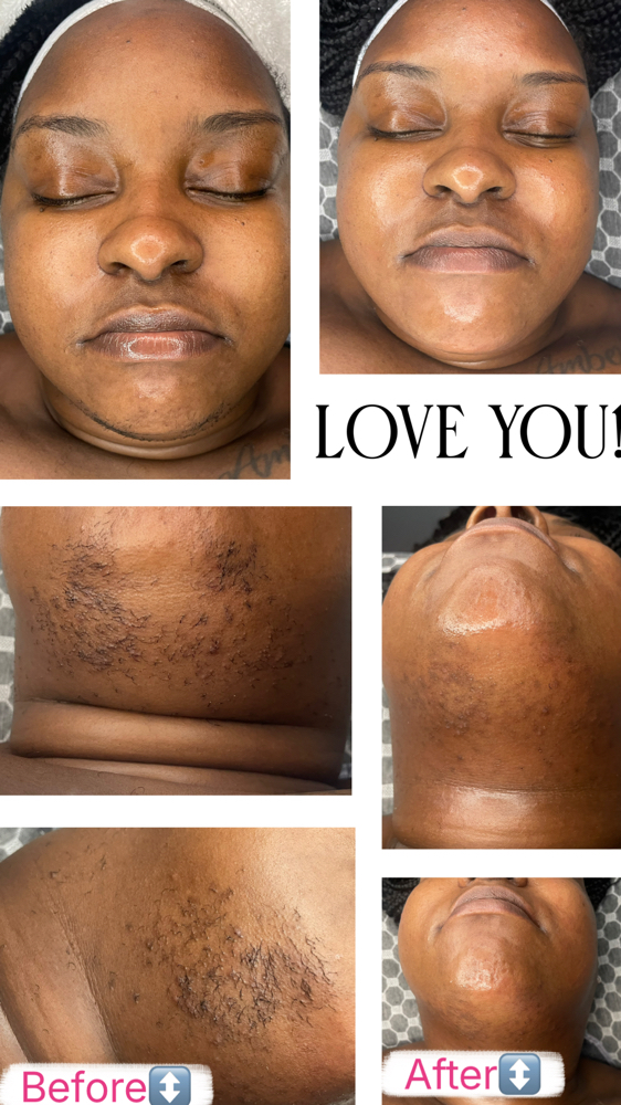 Chin Wax at The Sweet Spot Est. & More in Alexandria, LA