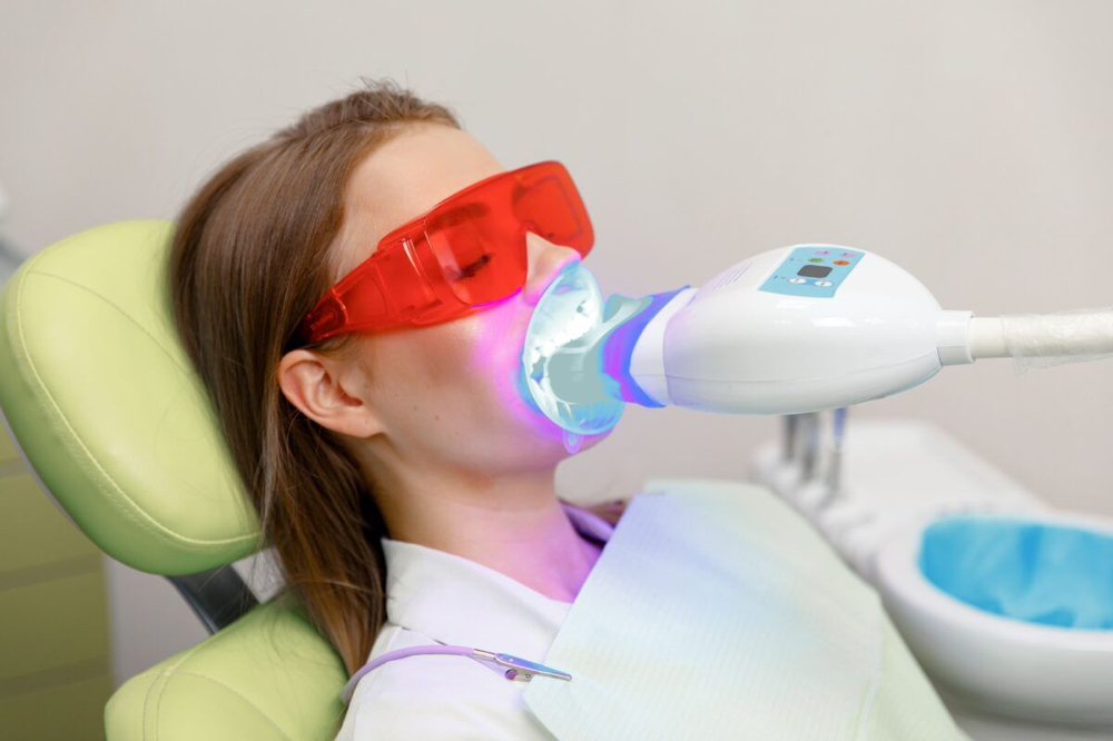 40 minute Teeth Whitening at Sunless Revolution Salon in san diego, CA