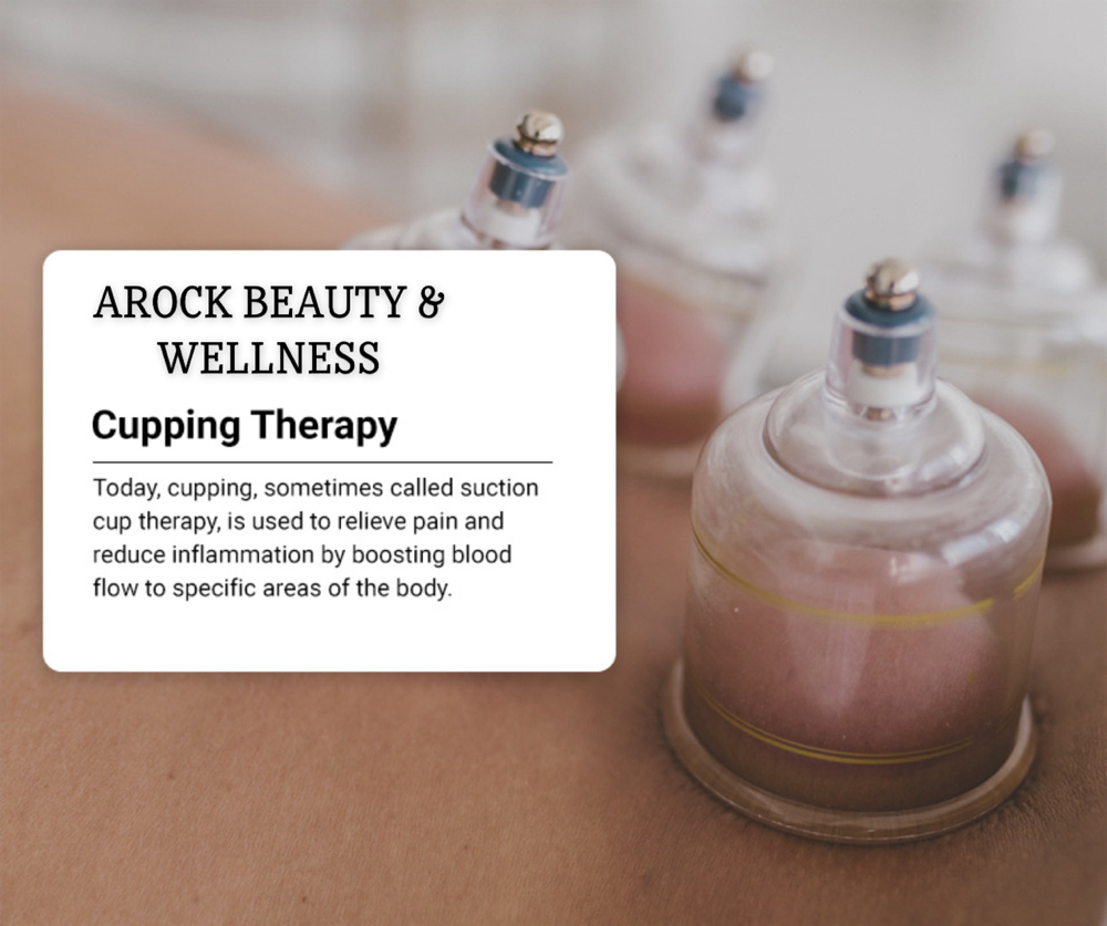 Cupping Therapy