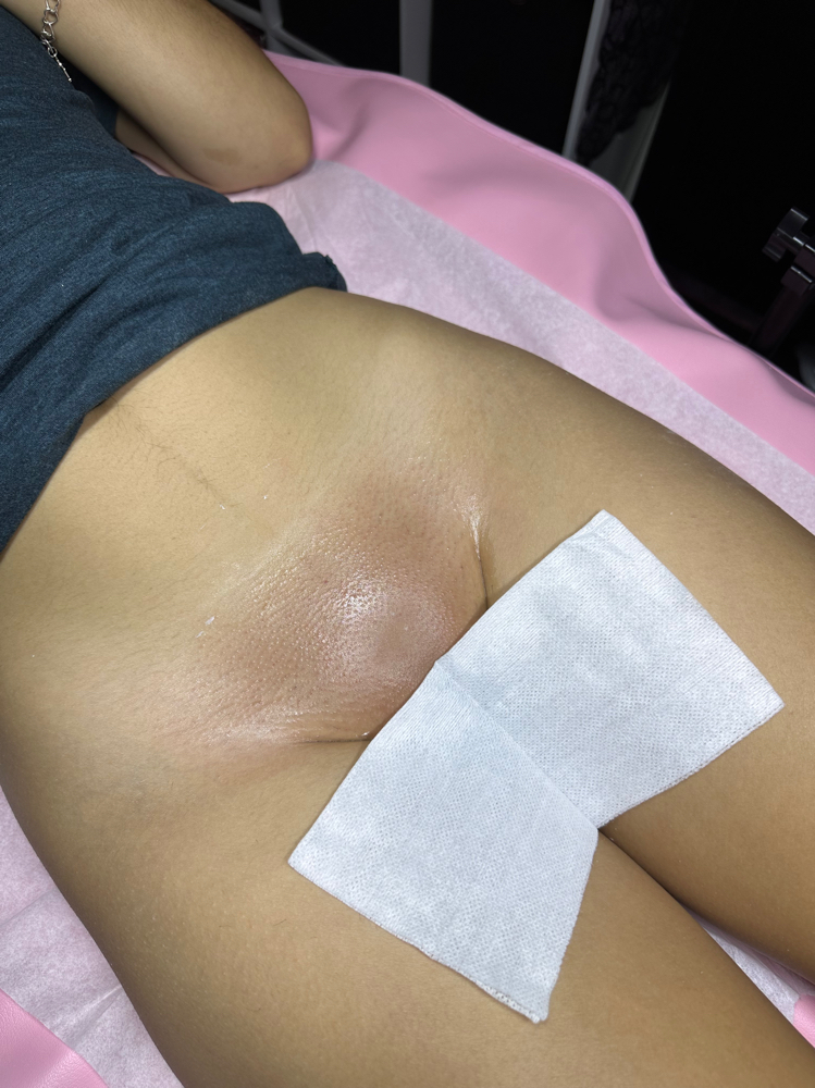 BRAZILIAN WAX