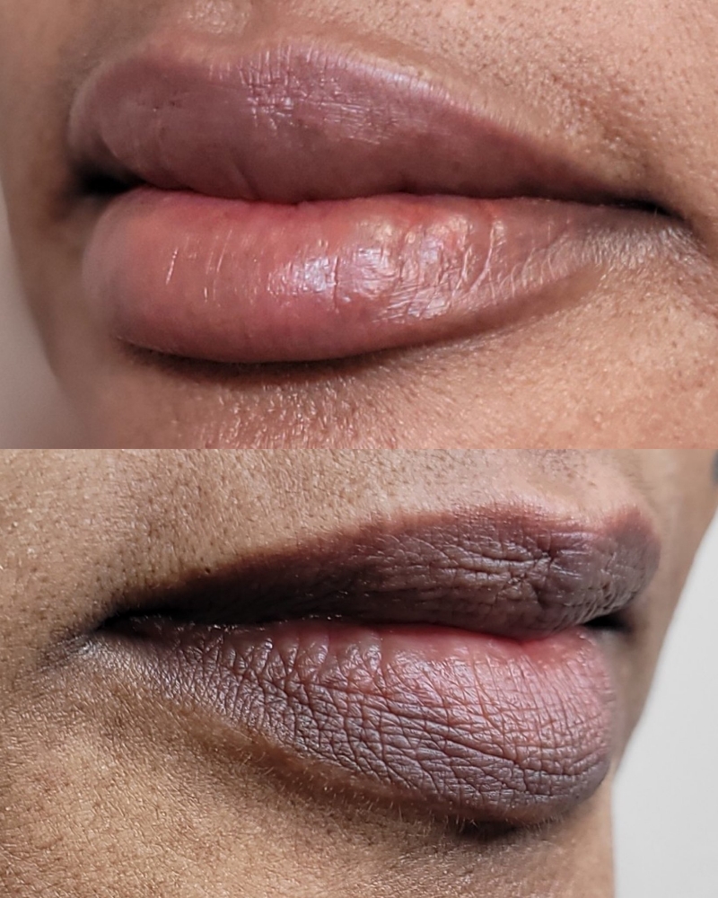 Lip Neutralization