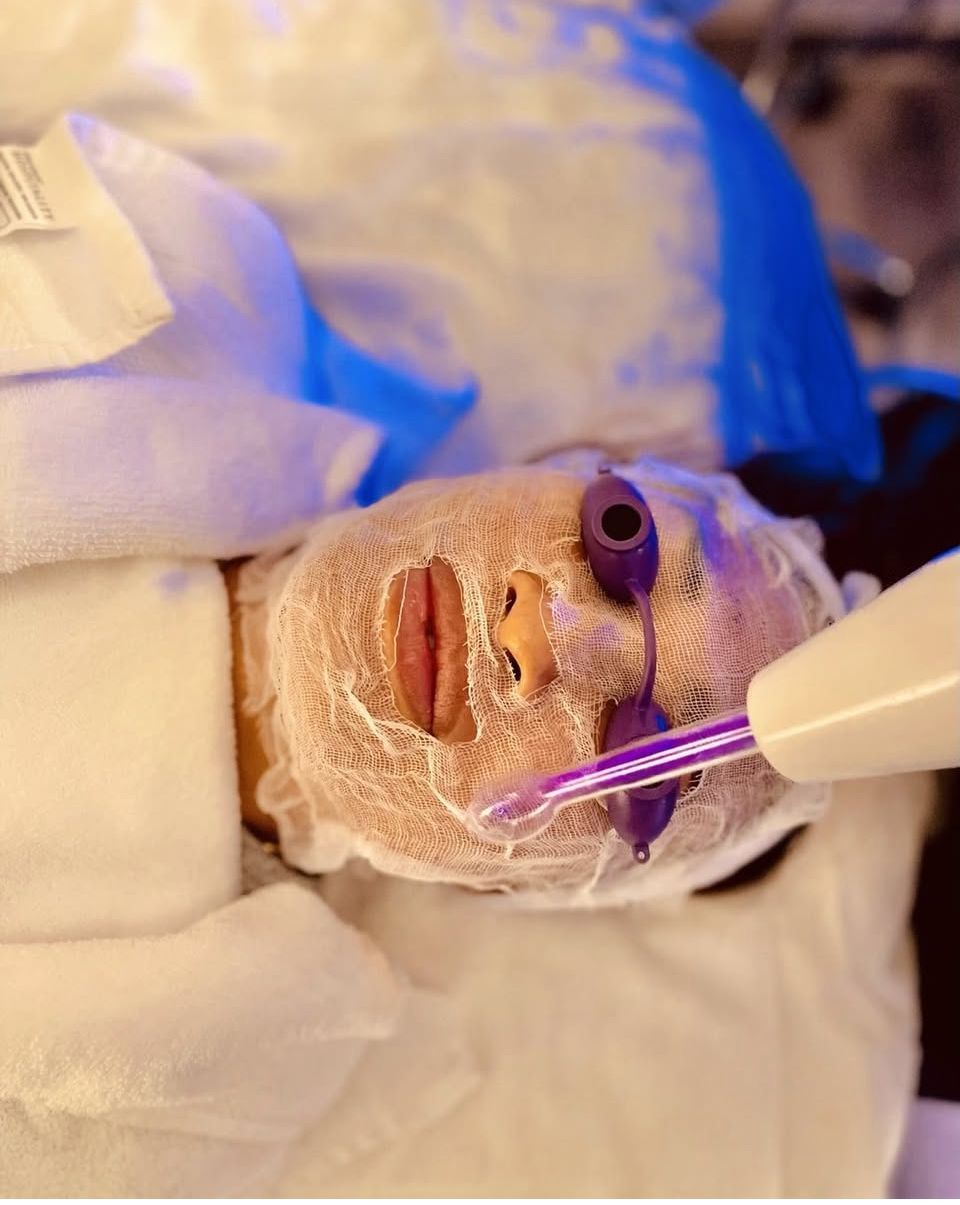 Detox/Acne Facial at Pop Beauty Studio in Torrance, CA