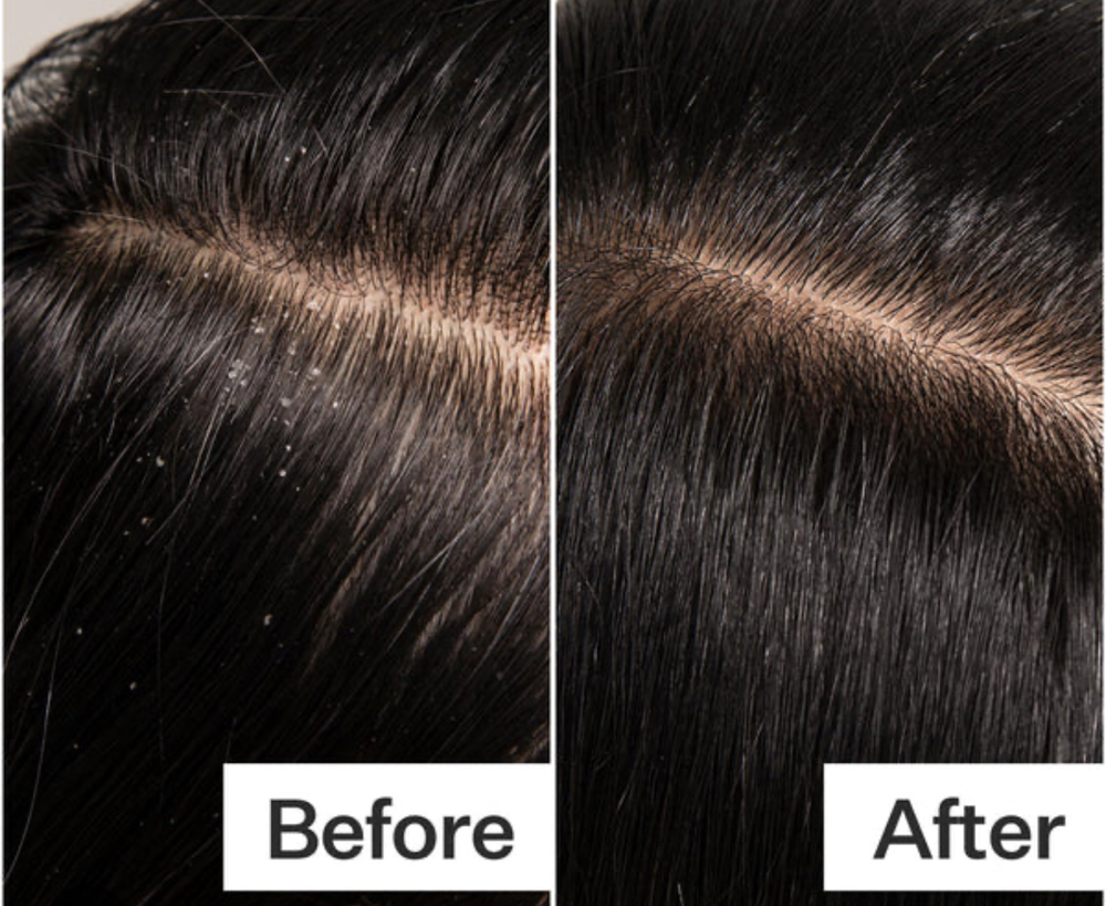 Scalp Detox Treatment