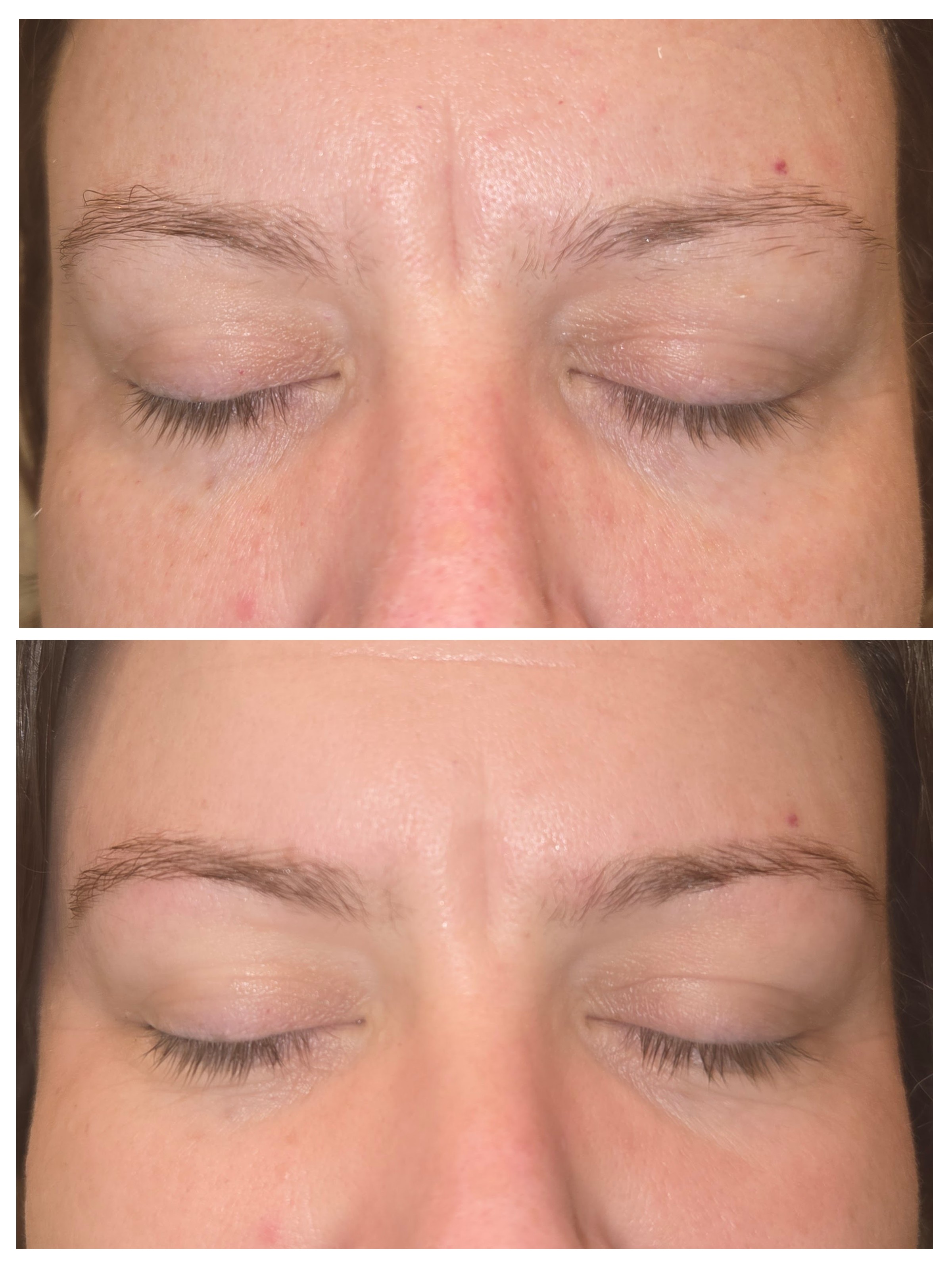 Brows