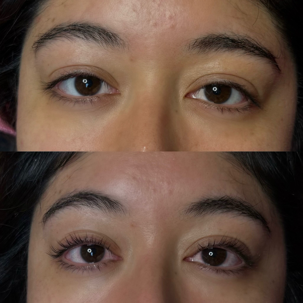 Eyelash Lift