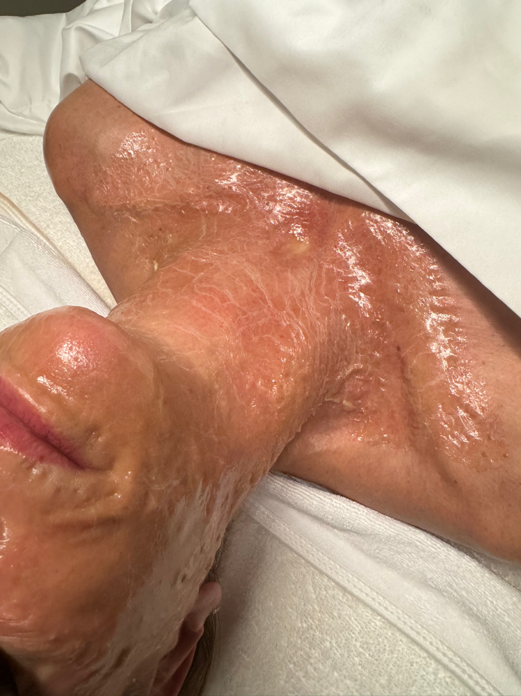 Firming Peptide Facial