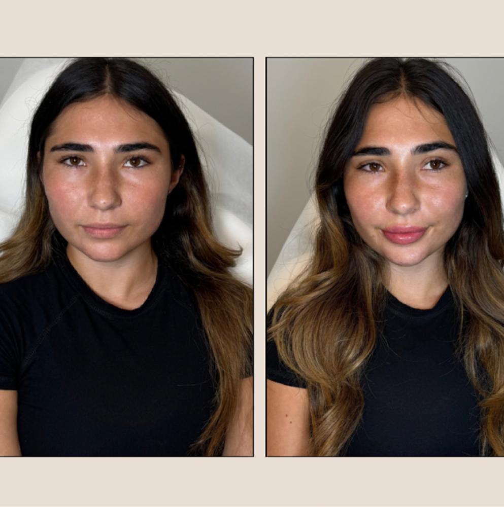 NEWCLIENT Nefertiti ToxLift Special at Lace Skn in West Lake Hills, TX
