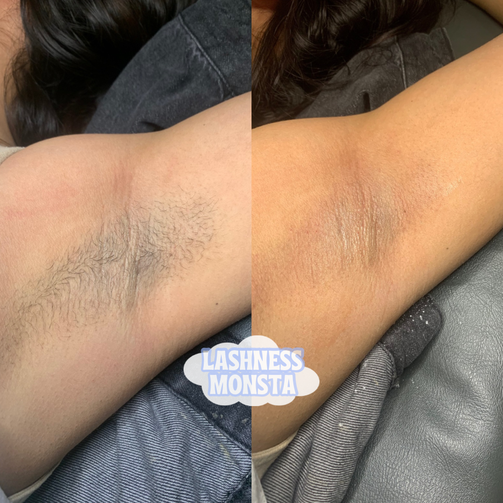 Underarm Wax