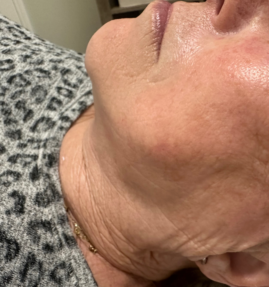 Anti-Aging Facial