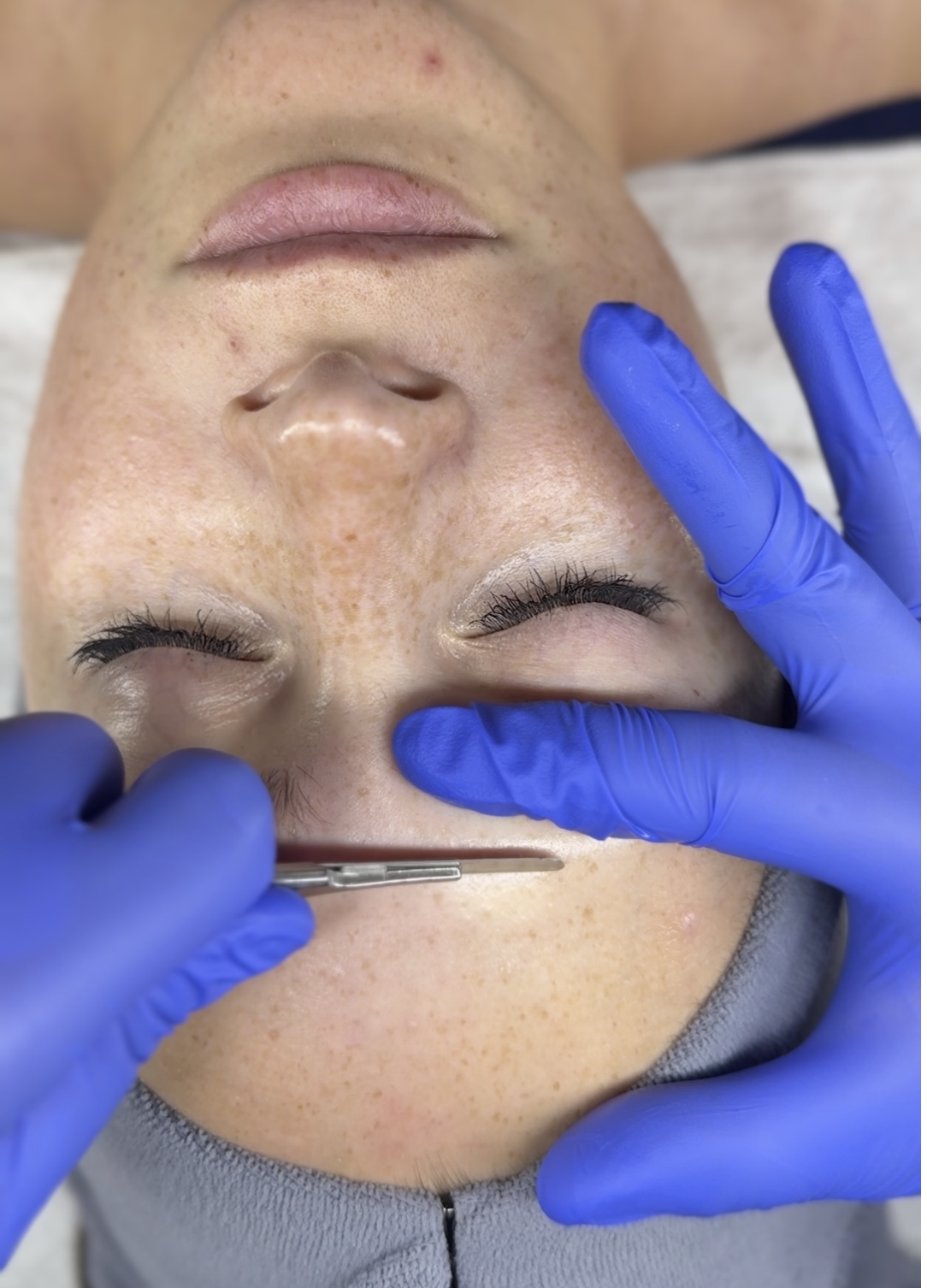 Dermaplane (Add-on enhancement)