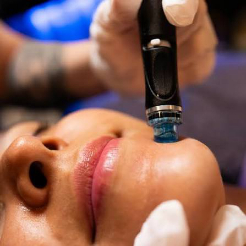 Hydrofacial at Haus of Beauty Studio in Hialeah, FL