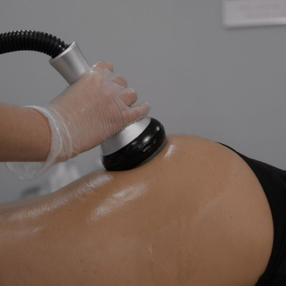 Glute Lift & Contour ( pkg X5 ) at Radiance Beauty Studio in McAllen, TX