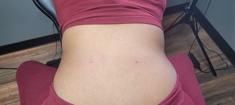 Dermals