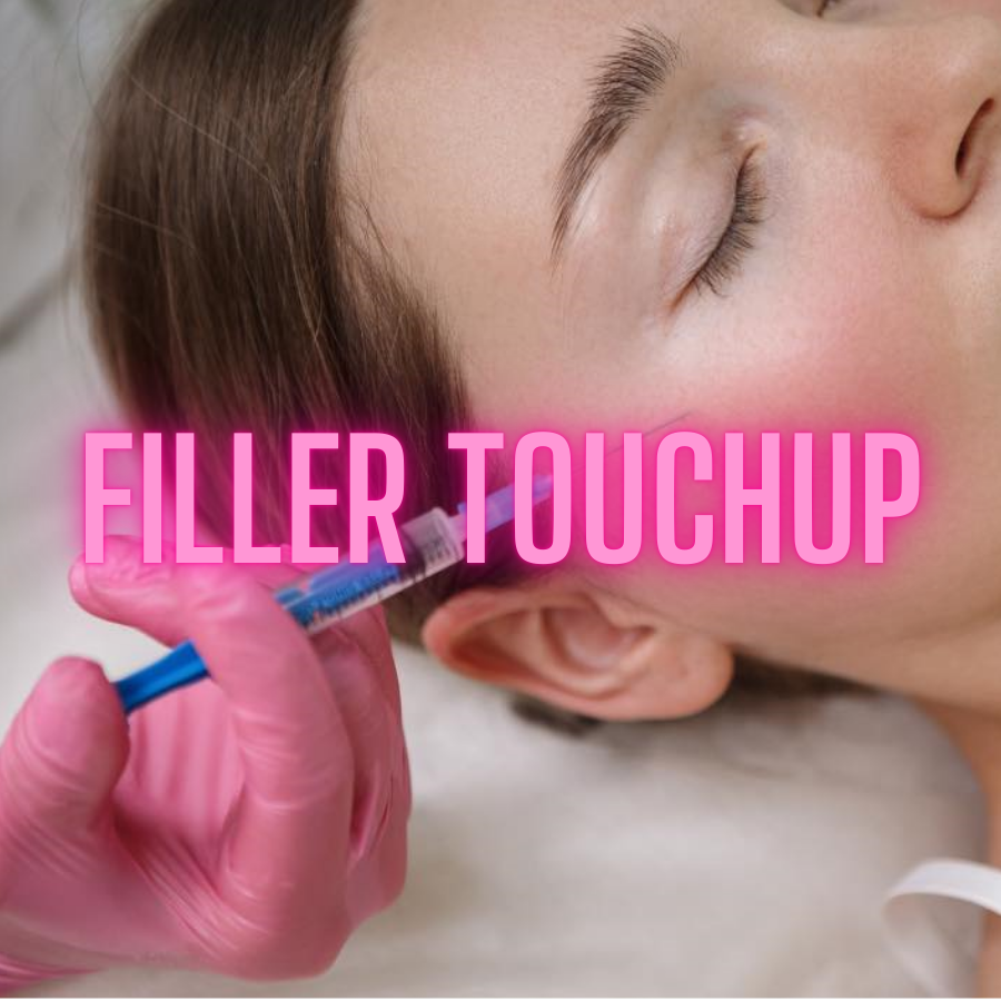 Two Week Filler Touchup