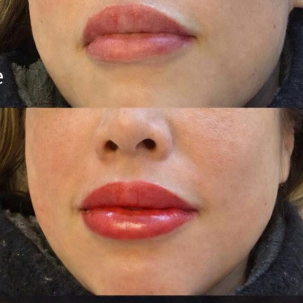 (1st) Session Lip Blush W/ Lana at Afterglow By Kendra in Lakewood, NJ