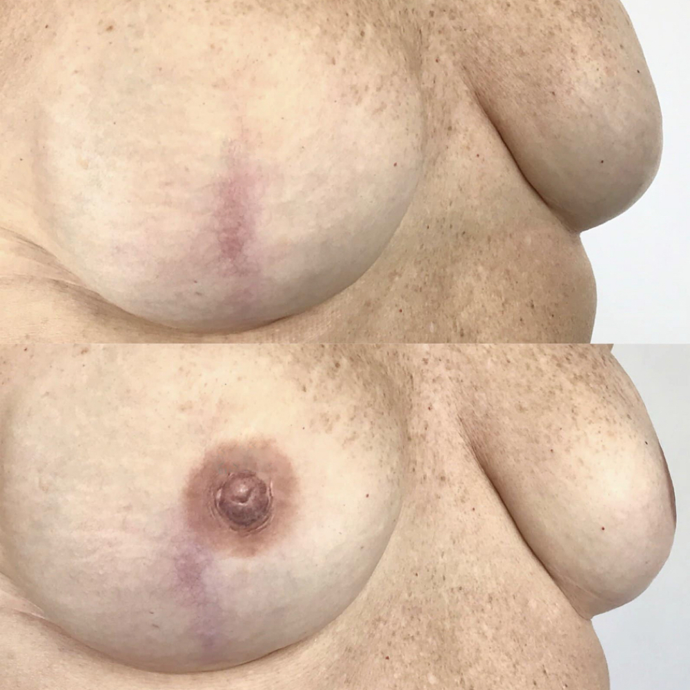 3D Areola Restorative Tattoo at SALCIE SKIN COMPANY in Raleigh, NC