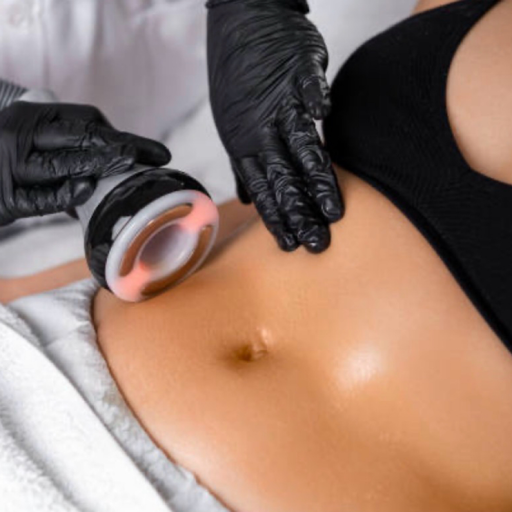 Sculpt & Tighten Package at Elite Wellness Body & Skin Studio in Jackson, GA