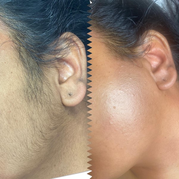 Full Face Wax