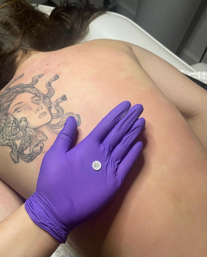 Back Facial Treatment