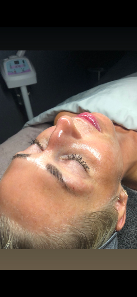 Hair Removal Facial