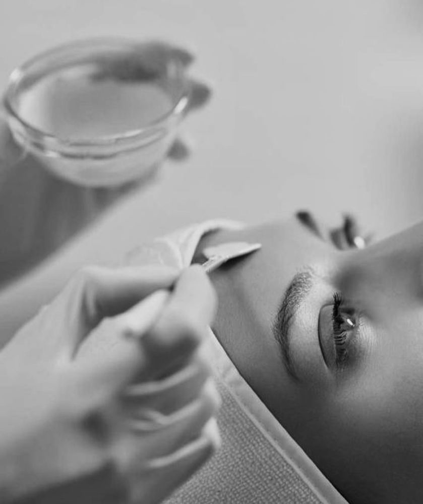Medium Chemical Peel