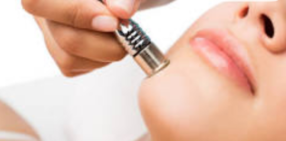 Microdermabrasion