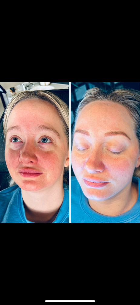 Follow Up/touch Up