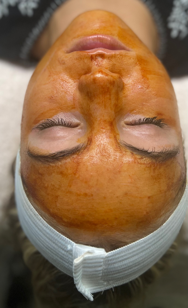 Facial Dermal Infusion (Anti-aging) at Trubeauty Esthetics in Idaho Falls, ID