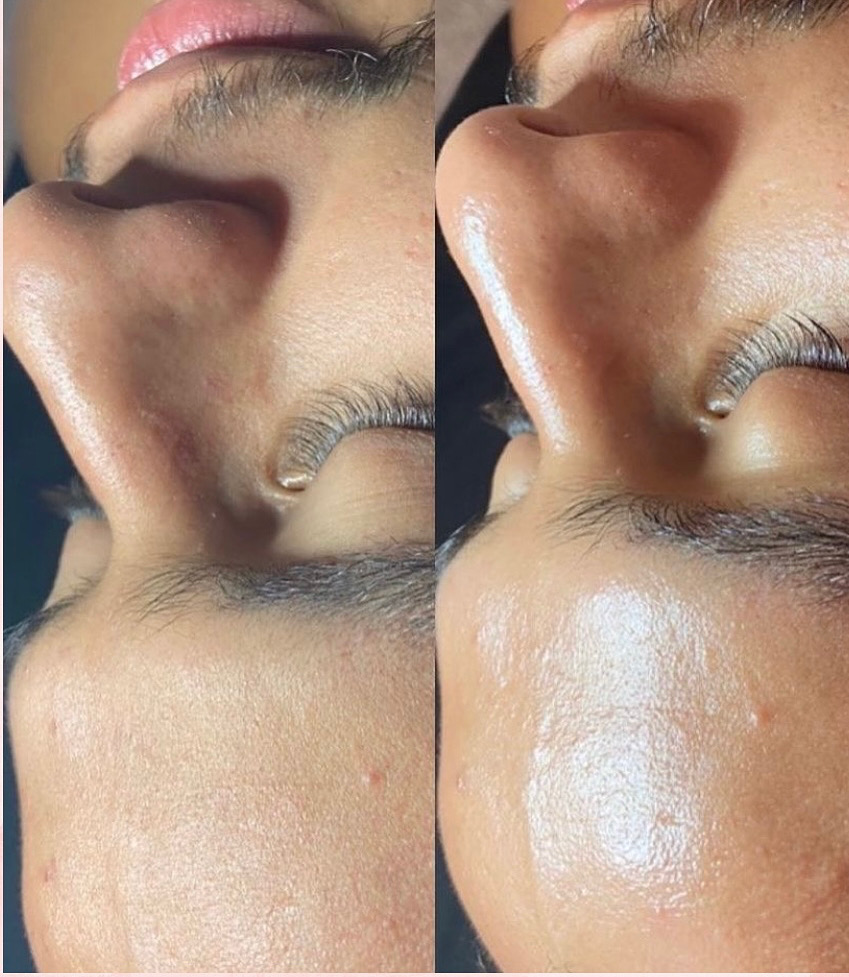 Gentlemans Facial