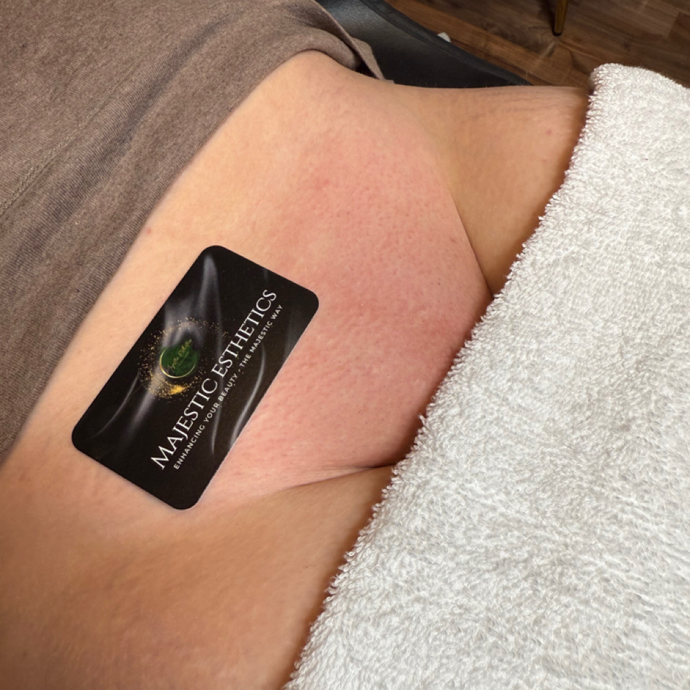 Brazilian Wax at Majestic Esthetics in Vacaville, CA