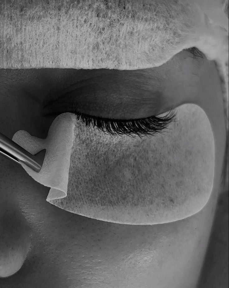 Lash Removal (My Work)