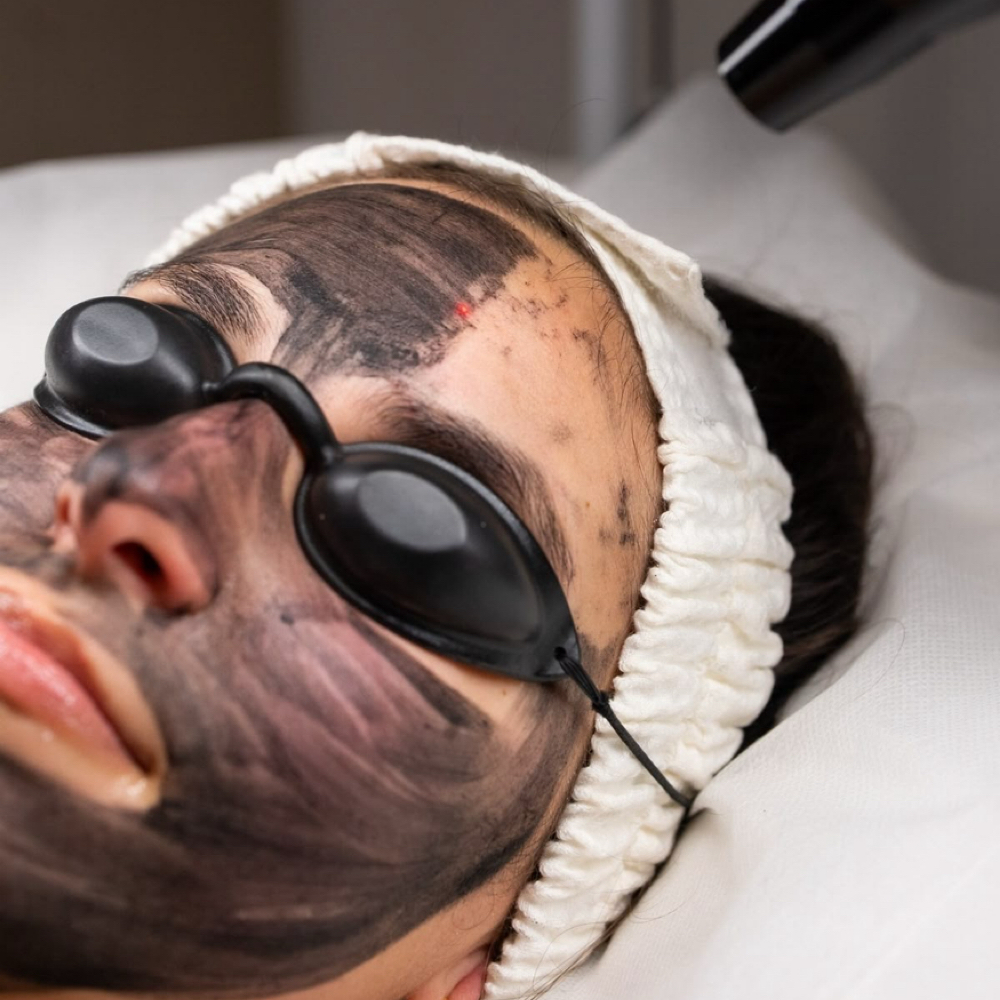 Hollywood Peel🔦 at Marbett Beauty Salon in Riverside, IL