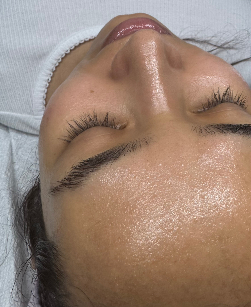 The Glow Facial