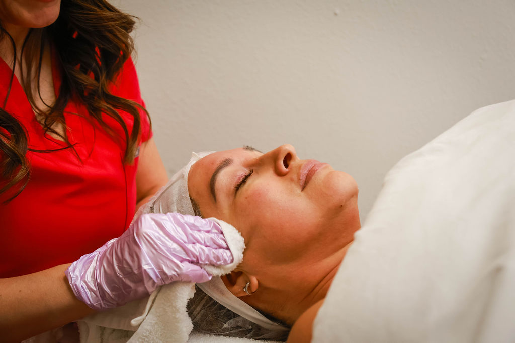 Chemical Peel. Consult  Required. at Flawless Beauty by Jojo in Pasadena, TX