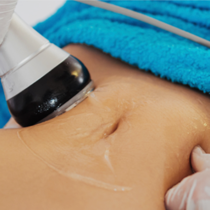 4 Post Op Lymphatic drainage at Glo'Up Body Spa in Atlanta, GA