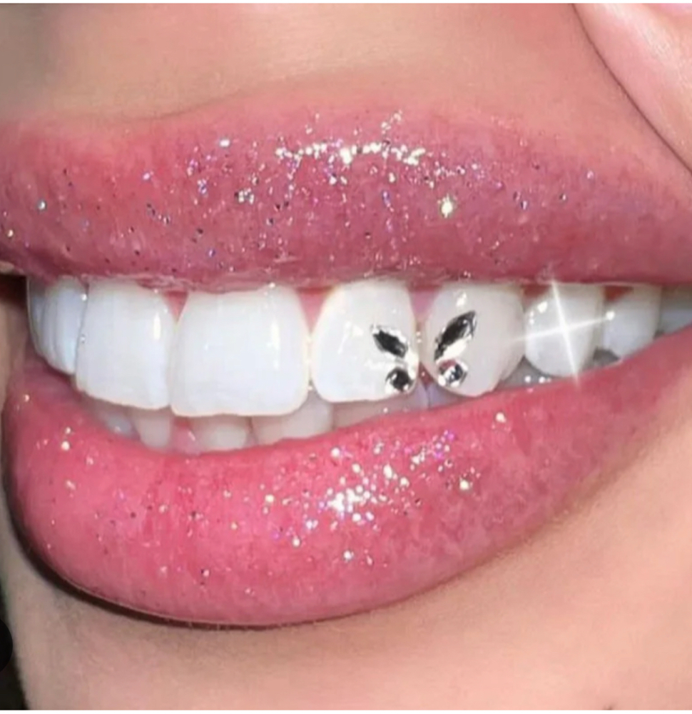 ✨Teeth Gems 💎✨