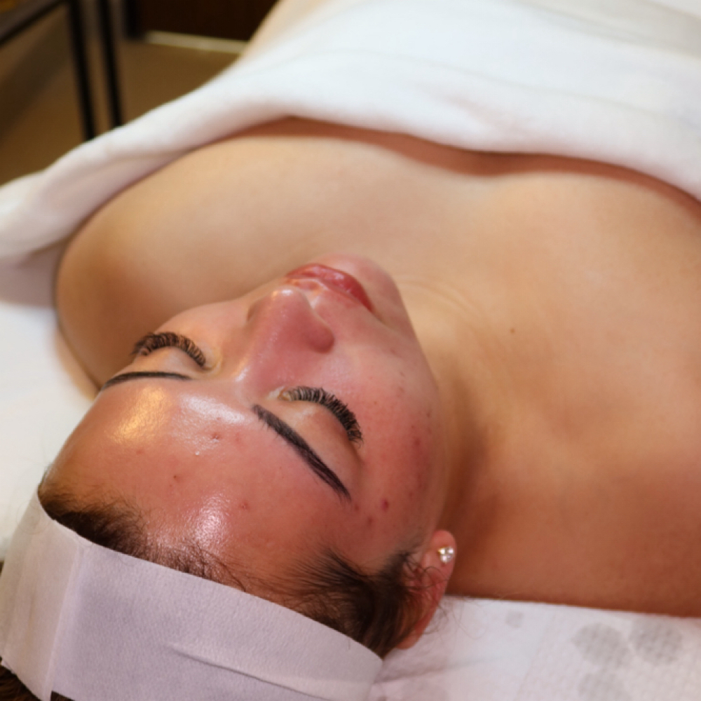 Beauty Peel at Lumis MedSpa in Houston, TX