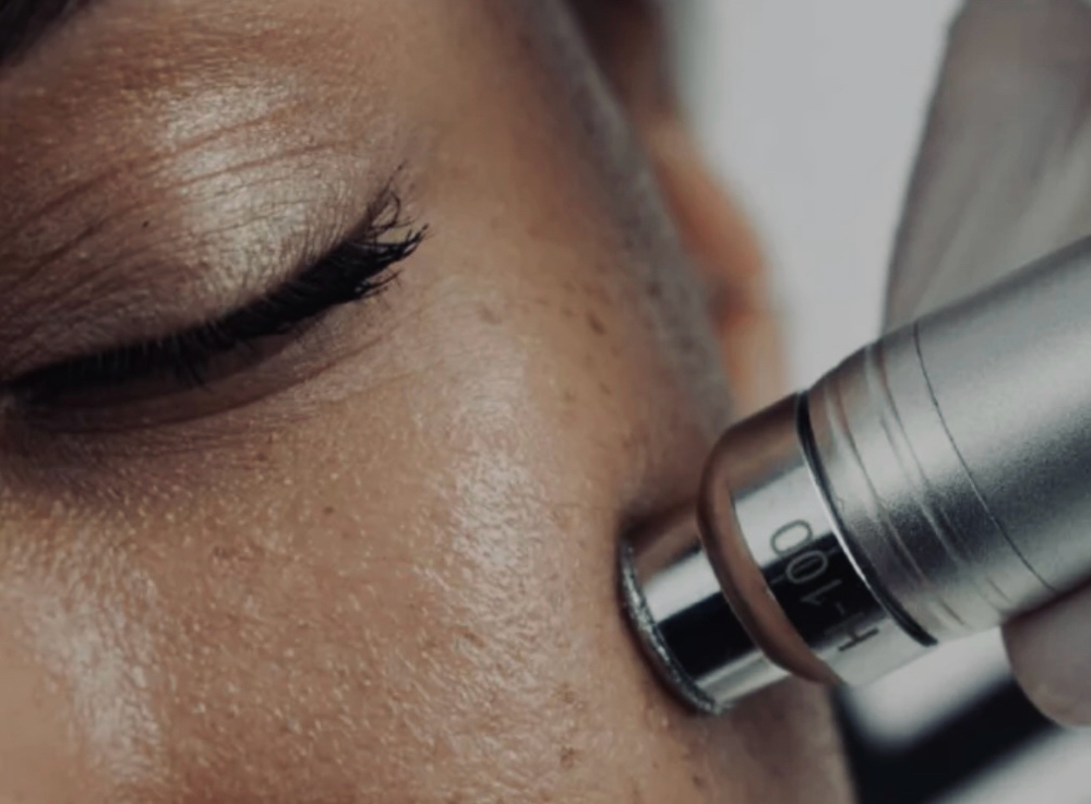 Hydro Diamond Facial