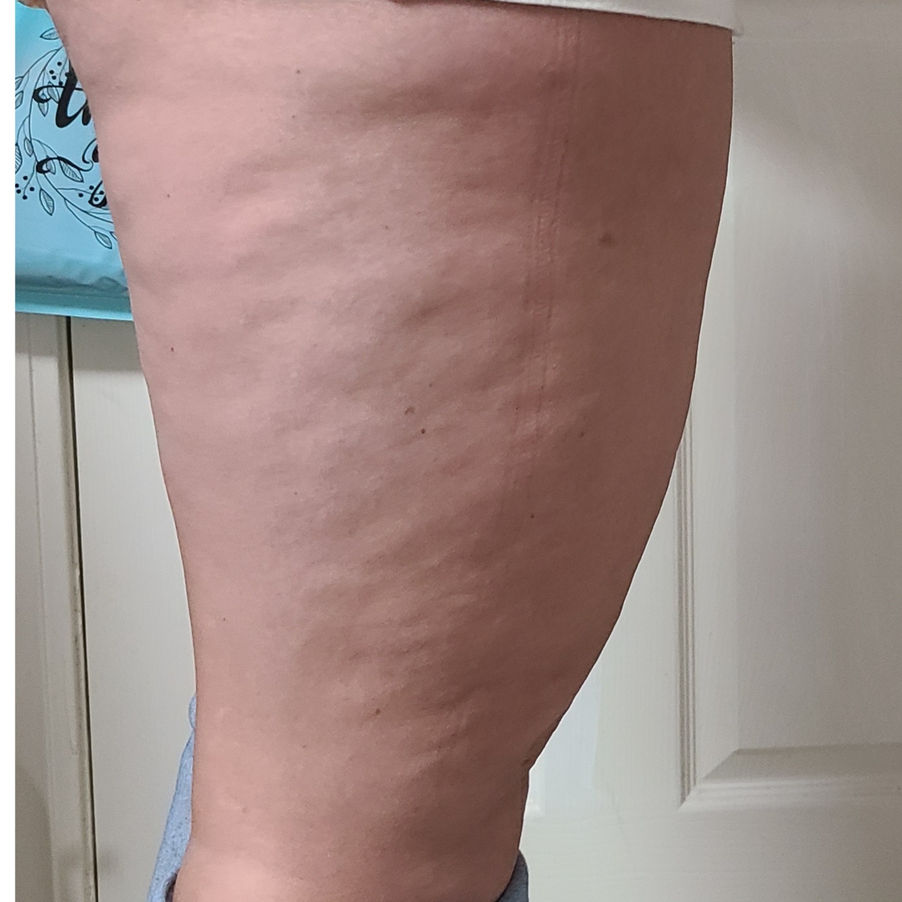 LegSculpt ~ Cellulite Program at Tiffany - Sculpted Beauty in Nettleton, MS