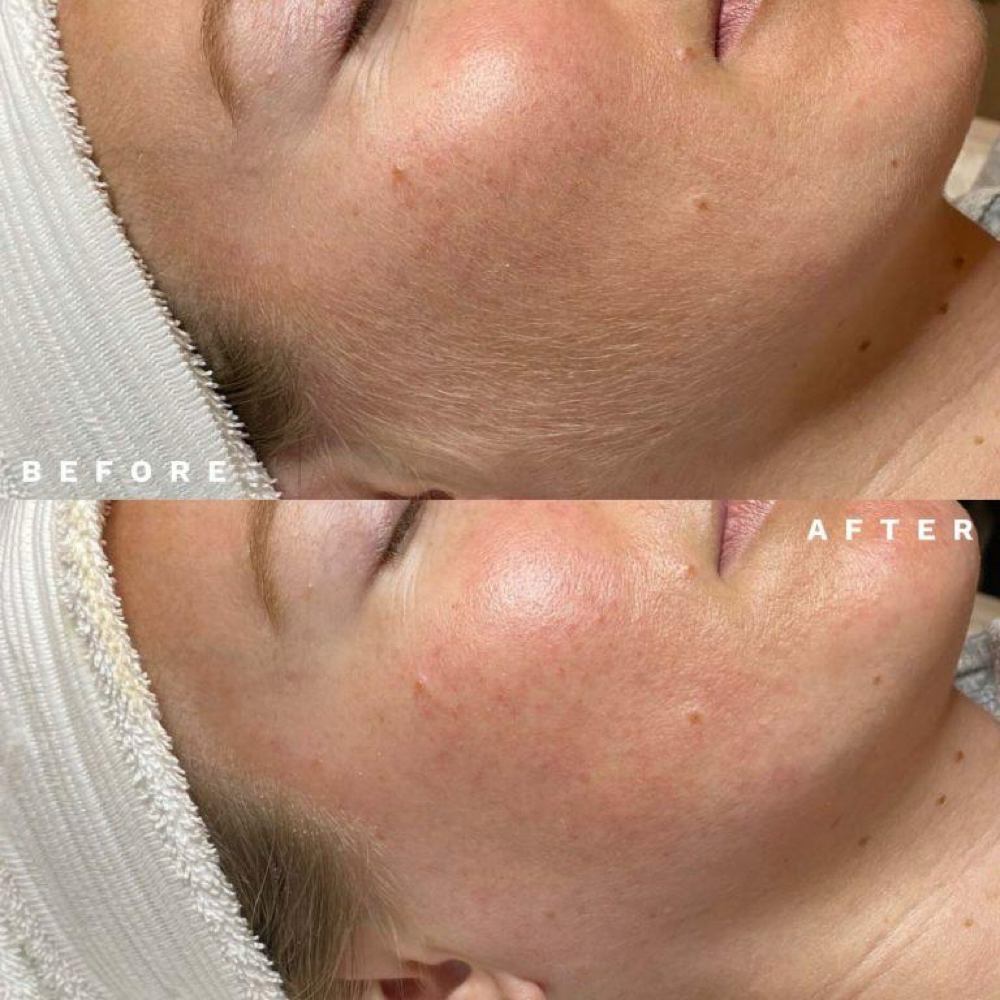 April Promos at Velour Aesthetics Studio in Bentonville, AR