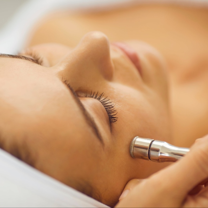 Microdermabrasion Treatment