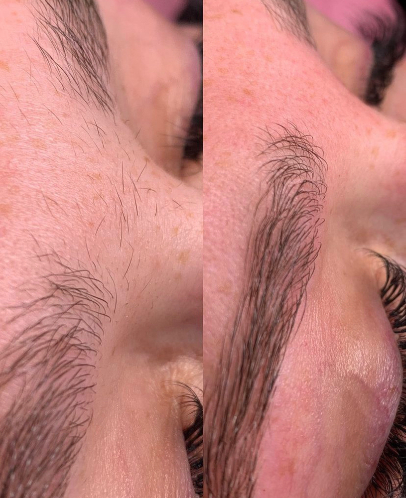 Brow Cleanup