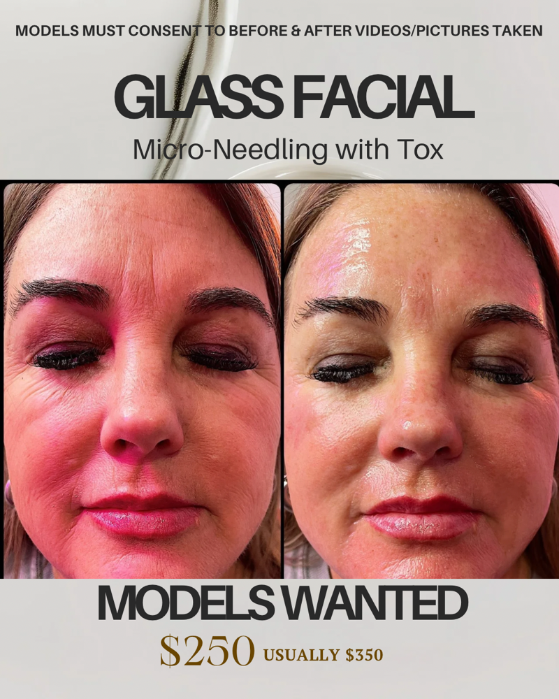 MODEL- Glass Facial
