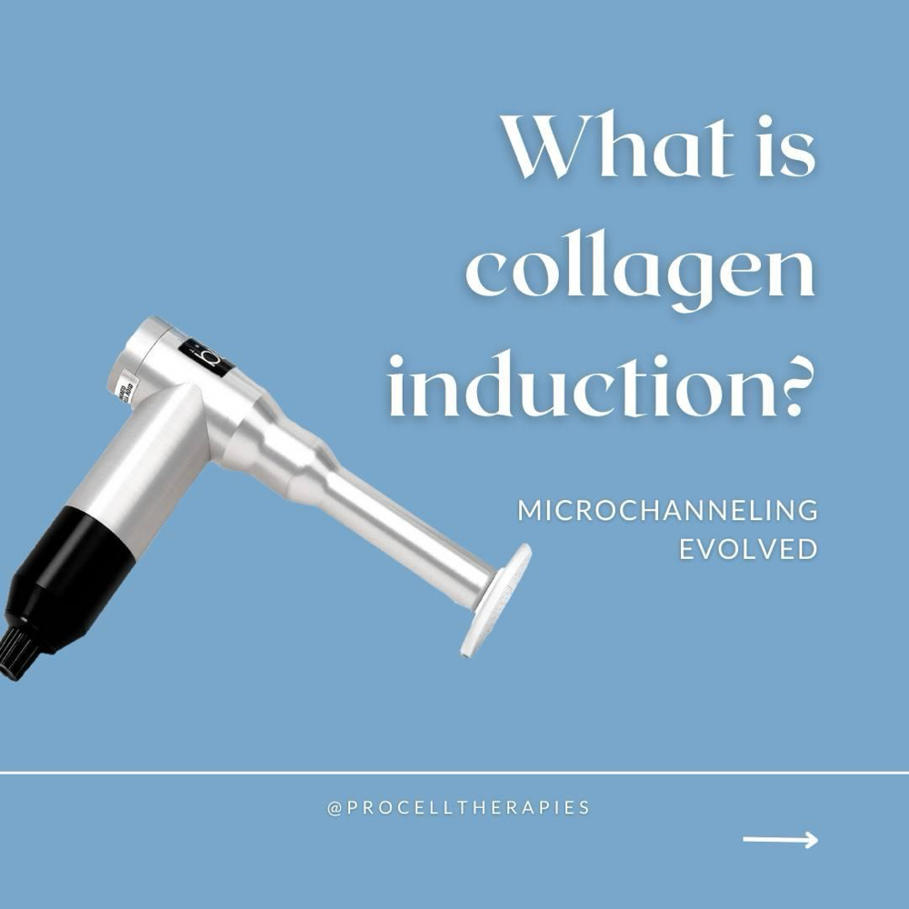 Microneedling PDRN + Growth Factors at Modern Beauty Skincare in UNIVERSITY PLACE, WA