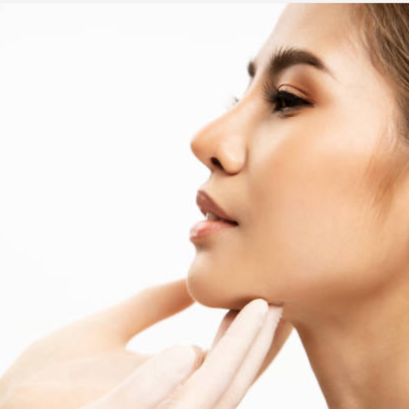 Chin Filler at Aesthetics by AM in Council Bluffs, IA