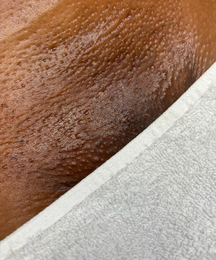 Full Brazilian Wax