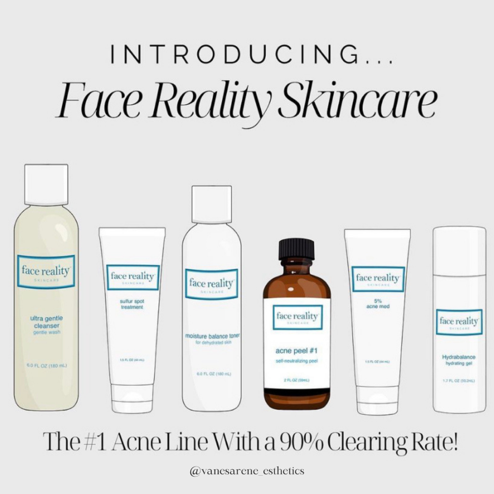 Acne Facials