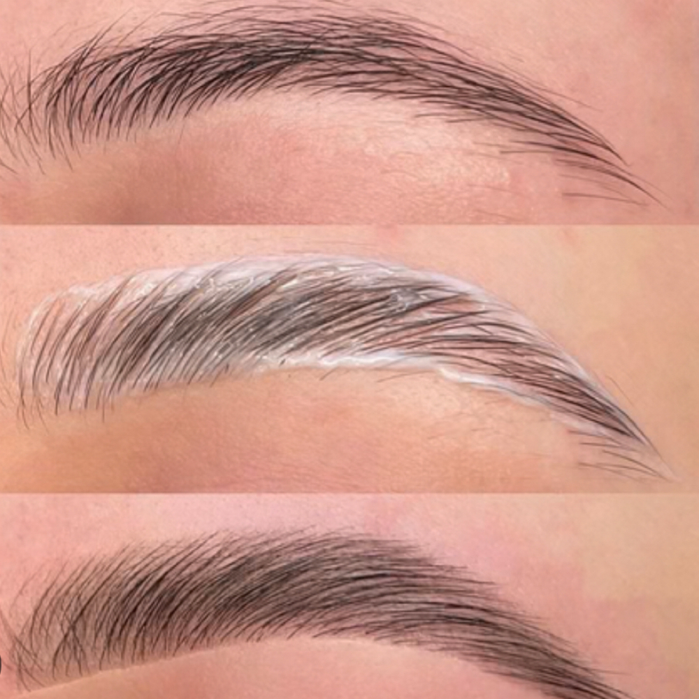 Crowned Brow Lift at Four Roots Beauty Collective in rock island, IL
